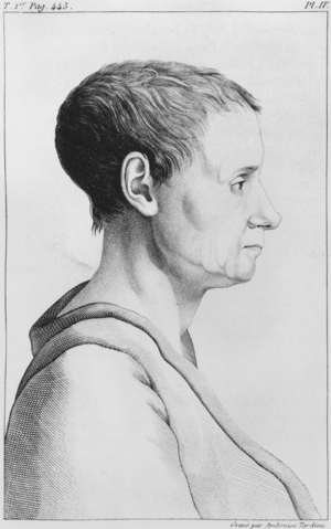 Theroigne de Mericourt, illustration from 'Des Maladies Mentales considerees sous le rapport medical, hygienique et medico-legal' by Etienne Esquirol (1772-1840) plate IV, 1838 (engraving) (b/w photo)