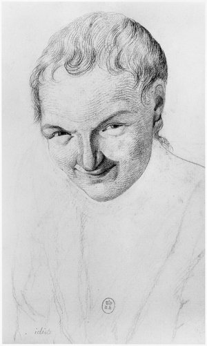 Idiot, illustration from an unpublished treatise by Jean Etienne Dominique Esquirol (1772-1840) on the lunatics of the Salpetriere asylum, c.1818 (pencil on paper)