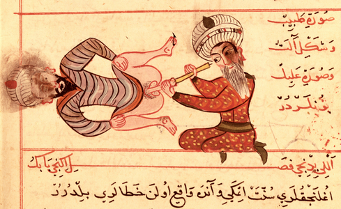 Ms Sup Turc 693 fol.96v Inspection of the Male Urethra, 1466 (vellum)