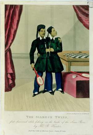 The Siamese Twins, First Discovered While Fishing on the Banks of the Siam River by Mr R. Hunter, 1829 (coloured engraving)