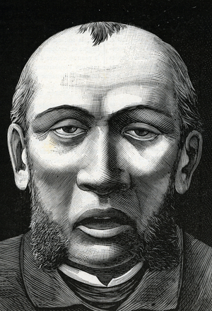 Patient with cerebral softening (engraving) 1888