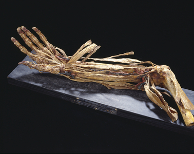 Ecorche of Honore Fragonard/Bras and hand/Musee Fragonard of the veterinary school of Maisons-Alfort/Val de Marne/Ile de France/France