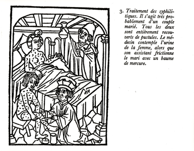 Treatment of a Syphilitic Couple with Mercury Balm (xylograph) (b/w photo)