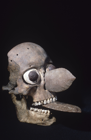 Skull of a man with false eyes, nose and tongue (bone & stone)