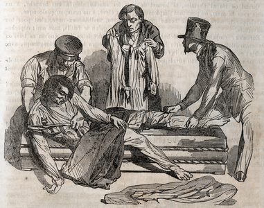 Accident medicine - on the most effective relief to be given to the drowned people, 1852 (engraving)