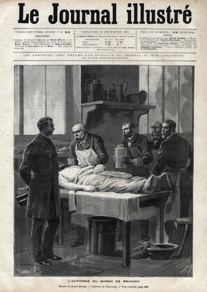 The autopsy of Baron Jacques de Reinach (1840-1892) in 1892 - engraving by Meaulle in “The Illustrous Journal” of 1892