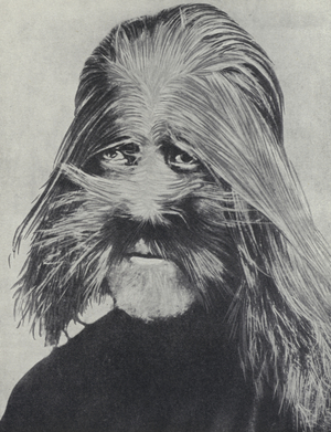 Hairy man of the mountains, Gansu Province, China (b/w photo)