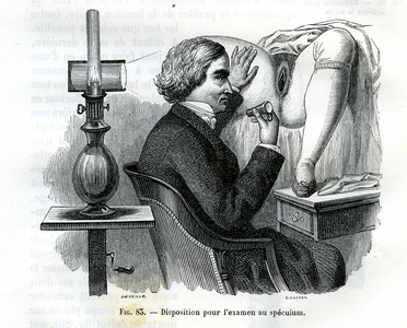 Arrangement for speculum examination, 1882 (engraving)