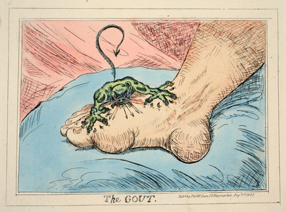 The Gout, pub. 1835 (hand coloured engraving)
