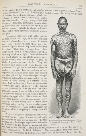 A piebald negro of the Loango Coast