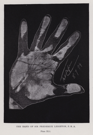 The hand of Sir Frederick Leighton (b/w photo)