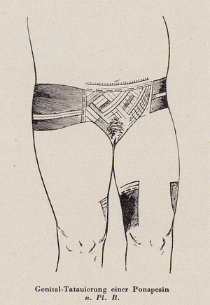 Genital tattoos of a woman of the Pacific island of Pohnpei (litho)