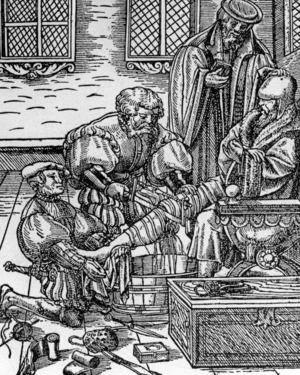 "Die Amputation" ("The Amputation"), 1500