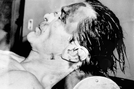 November 1975 Rome, Autopsy on the Corpse of Pier Paolo Pasolini, Killed at the Idroscalo Di Ostia on November 2 By Giuseppe Pino Pelosi And Unknown (b/w photo)