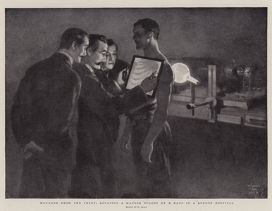 Wounded from the Front, locating a Mauser Bullet by X Rays in a London Hospital (engraving)