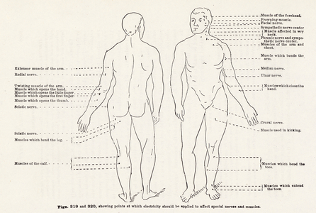 Treatment by Electricity (engraving)