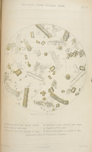 Deposits from cholera urine.