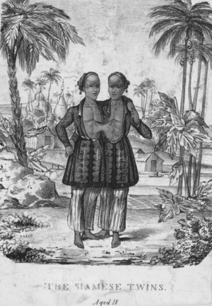 Thailand: An early engraving of the Siamese Twins Chang and Eng.