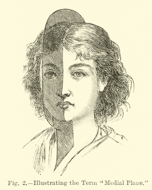Illustrating the Term "Medial Plane" (engraving)