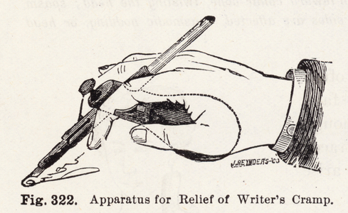 Apparatus for Relief of Writer's Cramp (engraving)
