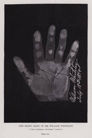 The right hand of Mr William Whiteley, "The Universal Provider," London (b/w photo)