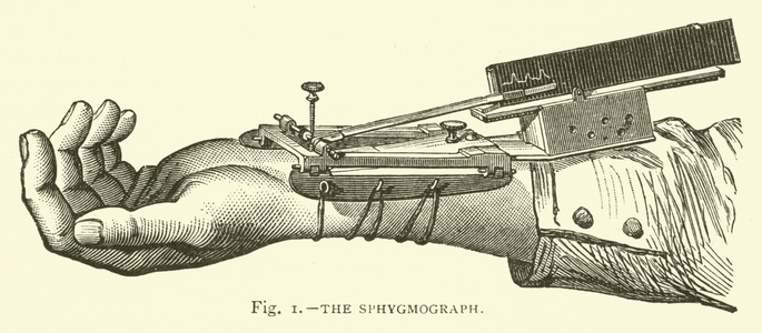 The Sphygmograph (engraving)