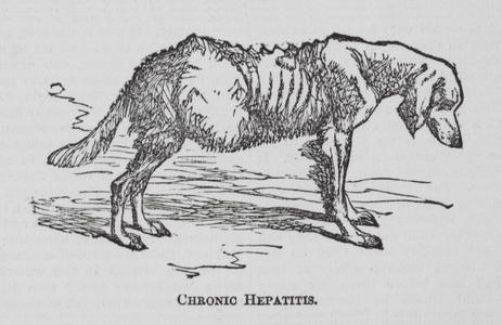Chronic Hepatitis (engraving)