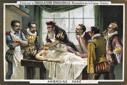 Ambroise Pare (1509-1590) French military surgeon, operating on a patient. Chromolithograph c1900.