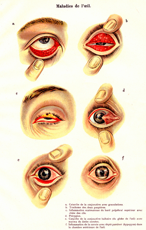 Eye diseases,1907 (print)