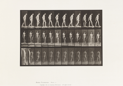 Plate 559. Disseminated Sclerosis; Walking with Cane, 1885 (collotype on paper)