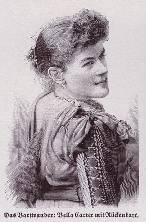 Bella Carter, the woman with a beard on her back (litho)