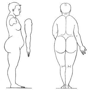 Matron (side view and back view). By Albrecht Dürer