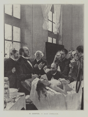Avant l'Operation (Before the Operation) (litho)