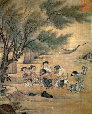 Country doctor applying a painful cure of moxibustion (traditional Chinese medical therapy utilizing special