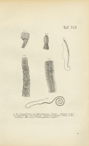 Parasitic Worms of Humans, 1850 (lithography)