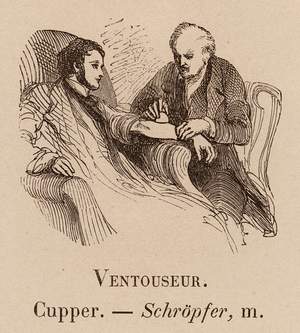 Le Vocabulaire Illustre: Ventouseur; Cupper; Schropfer (engraving)