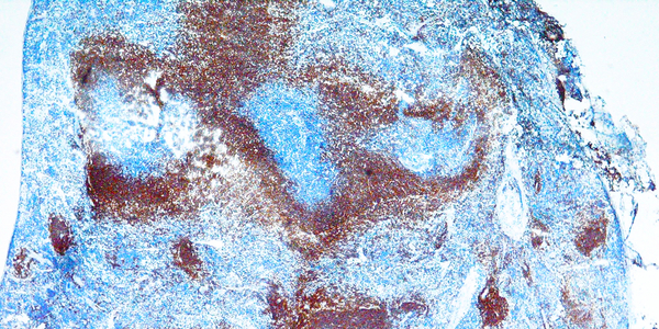 Immunoperoxidase staining of formalin-fixed, paraffin