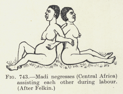 Madi negresses, Central Africa, assisting each other during labour (litho)