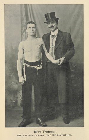 Before treatment. The patient cannot lift half-an-ounce.
