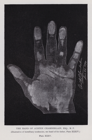 The hand of Austen Chamberlain (b/w photo)