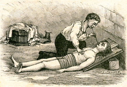 First aid: artificial respiration performed on a walnut tree around 1900 (illustration)