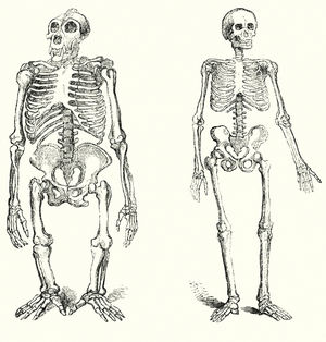 Skeleton of man and the Gorilla (engraving)