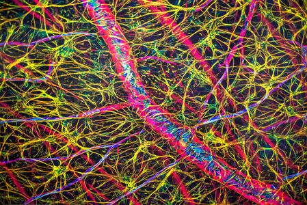 Astrocytes and blood vessels within the retina, Brain exhibition MIT Museum, Boston, 2021 (photo)