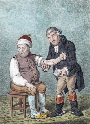 Bloodletting. Blood-letting. (print)