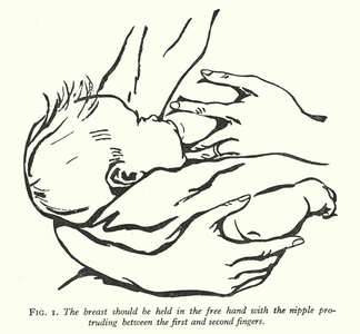 The breast should be held in the free hand with the nipple protruding between the first and second fingers (litho)