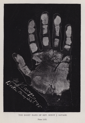 The right hand of Rev Minot J Savage (b/w photo)