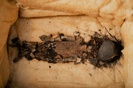 Fetus mummy, child of King Tut, Fetus 1, female, from KV62, Currently at Qasi Aini Ho…, 2009 (photo)