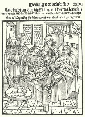 Doctors attending at the bedside of a man with a broken leg (engraving)