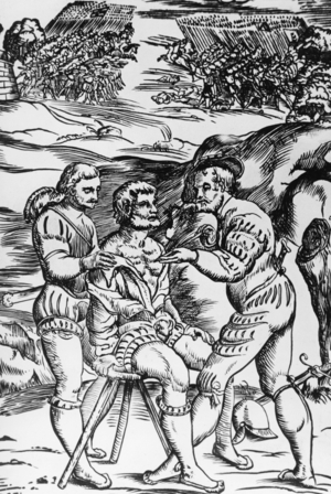 Pulling out of an arrow, 1528