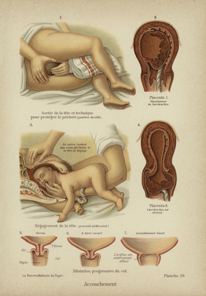 Childbirth (colour litho)